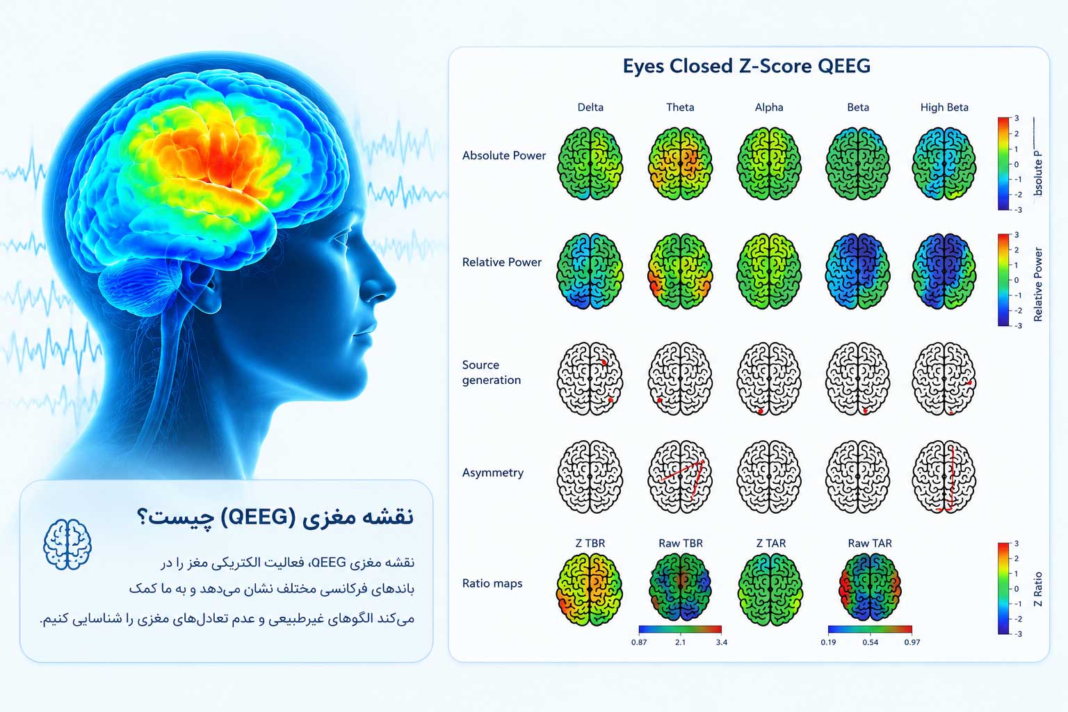 نقشه مغزی (qEEG) چیست؟